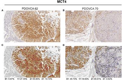 In situ Metabolic Profiling of Ovarian Cancer Tumor Xenografts: A Digital Pathology Approach